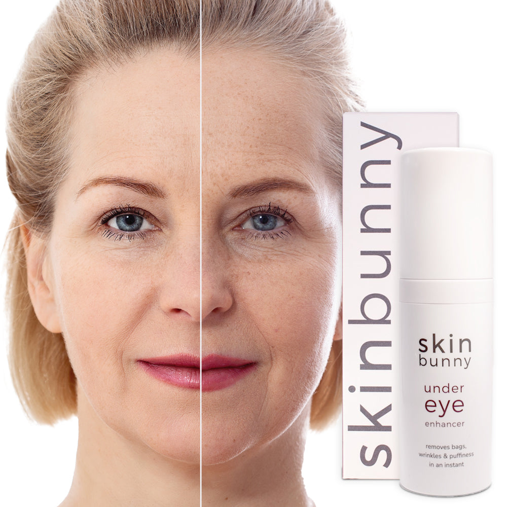 Una Skin Ltd